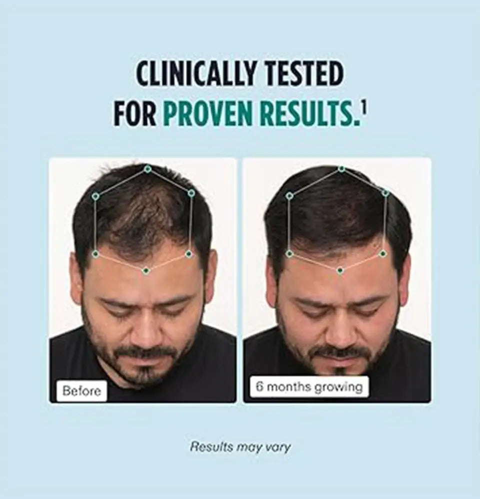 Nutrafol Men's Hair Growth Supplements – Clinically Tested for Thicker, Stronger Hair